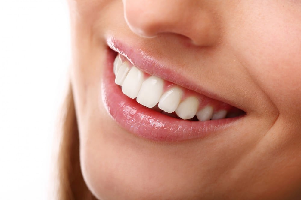 full-mouth rehabilitation-in-karuppayurani-madurai