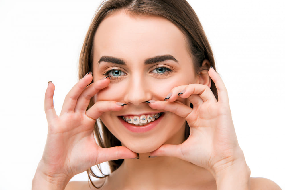 teeth-alignment-in-karuppayurani-madurai
